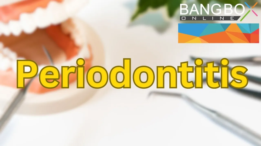 Periodontitis: A Gum Infection