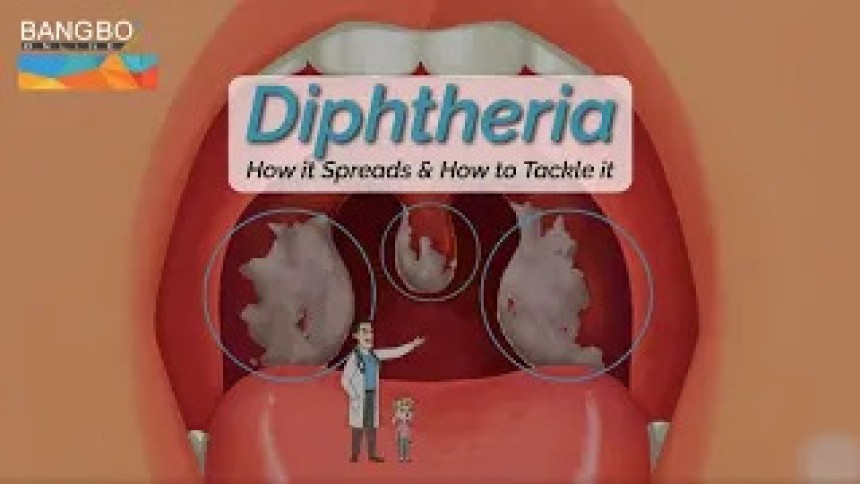 Diphtheria: a bacterial infection II Bang Box Online Official
