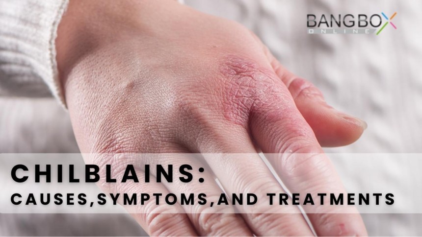 Chilblains: Causes, Symptoms, and Treatments II Bang Box Online Official