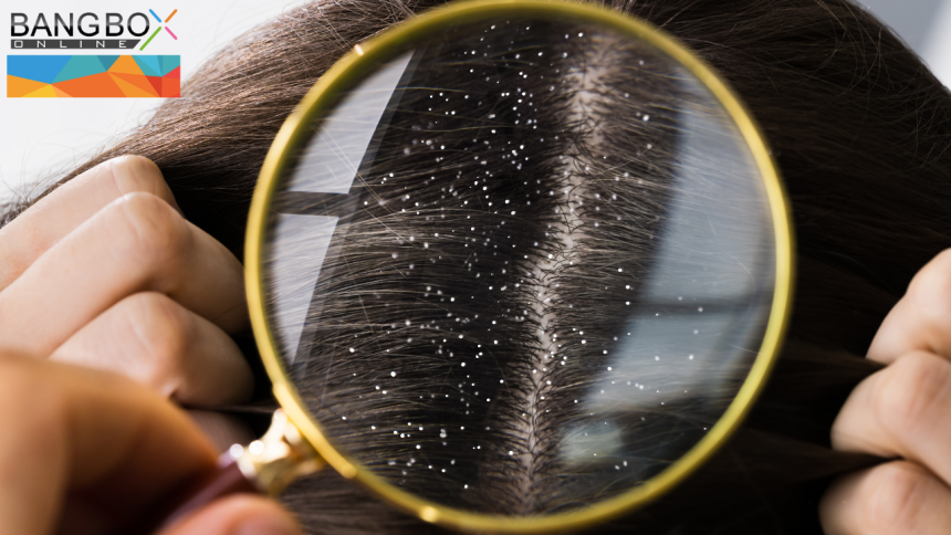 Unveiling the Hidden Impact: Exploring the Drawbacks of Dandruff and the Imperative for Care