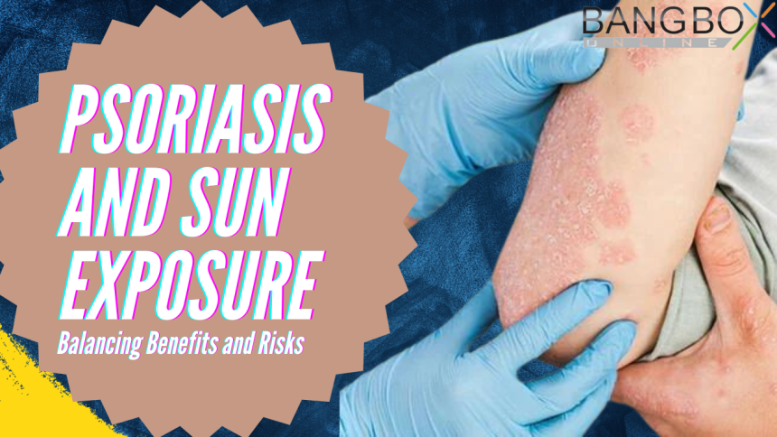 Psoriasis and Sun Exposure: Balancing Benefits and Risks