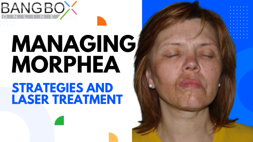 Managing Morphea Flare-Ups: Strategies and Laser Treatment