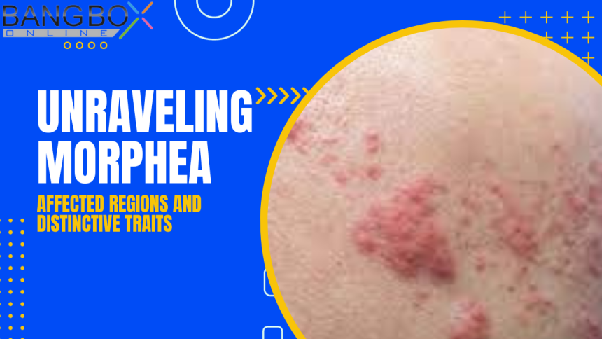 Unraveling Morphea: Affected Regions and Distinctive Traits
