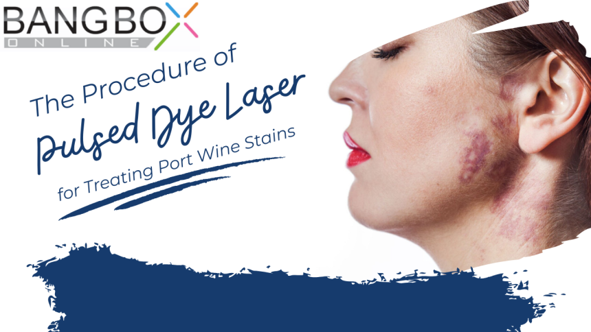 The Procedure of Pulsed Dye Laser for Treating Port Wine Stains