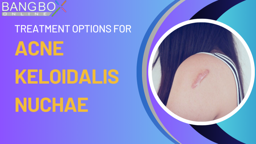 Treatment Options for Acne Keloidalis Nuchae