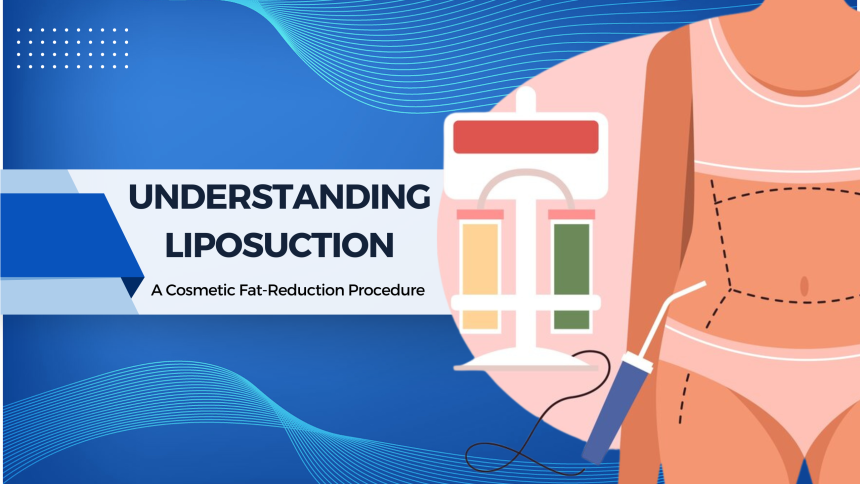 Understanding Liposuction: A Cosmetic Fat-Reduction Procedure