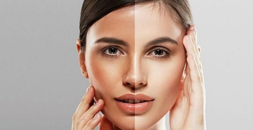 skin toning in Islamabad