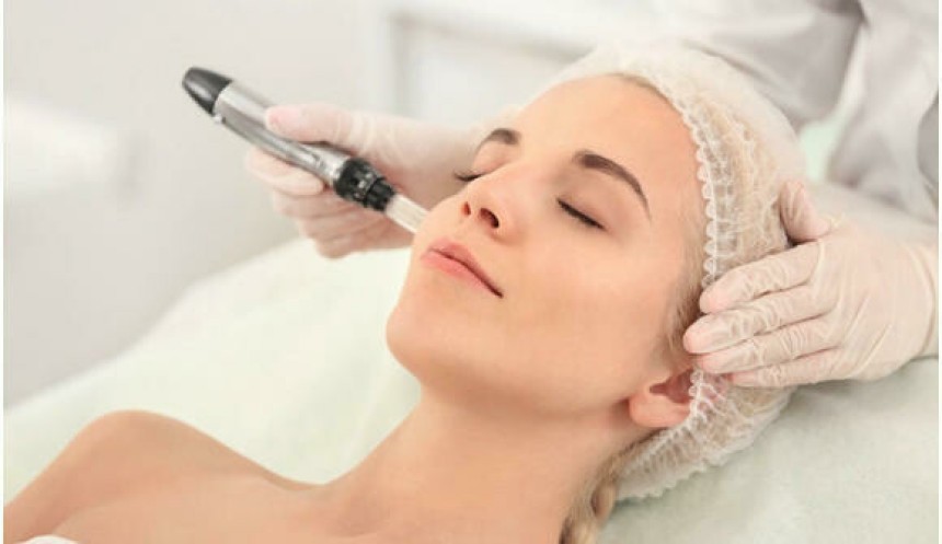 microneedling in Islamabad