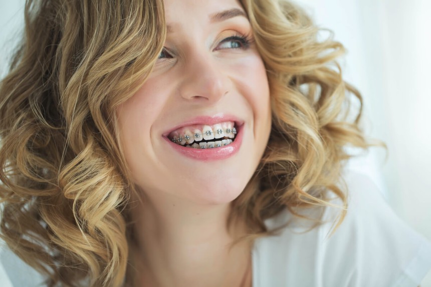 Dental braces in Islamabad