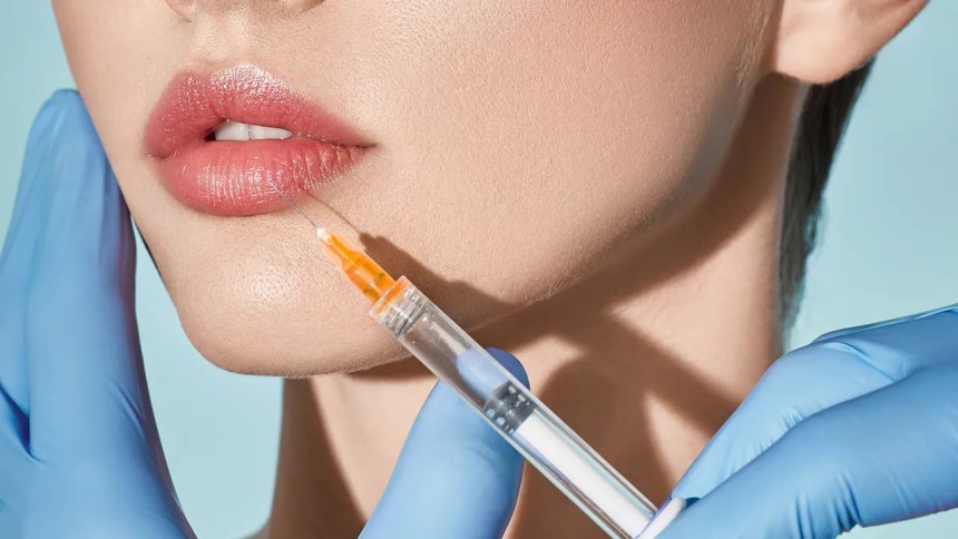 Can You Combine Russian Lip Fillers with Botox?