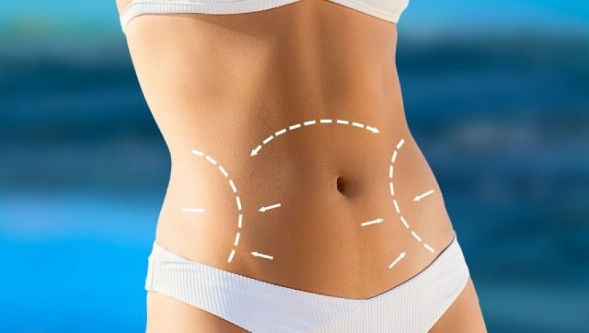 Tummy Tuck in Islamabad