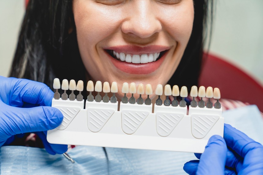 Dental Veneers in Islamabad