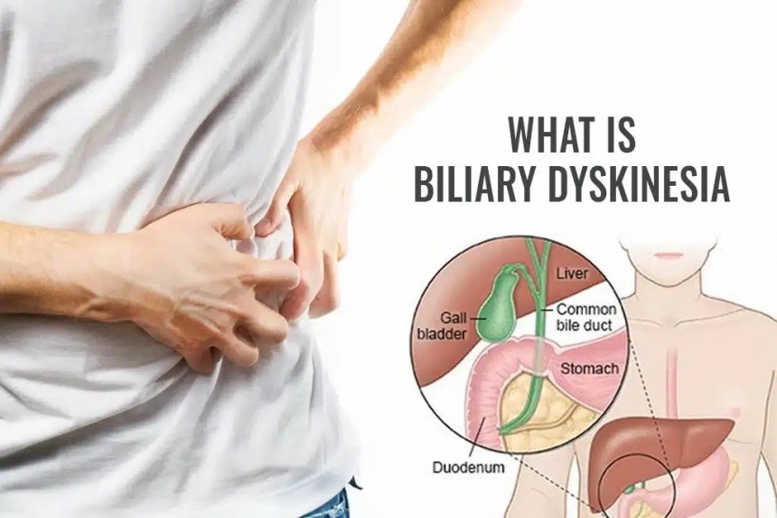 Biliary Dyskinesia