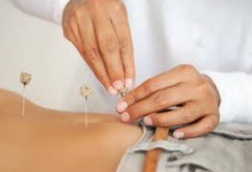 Fertility Acupuncture Bellingham