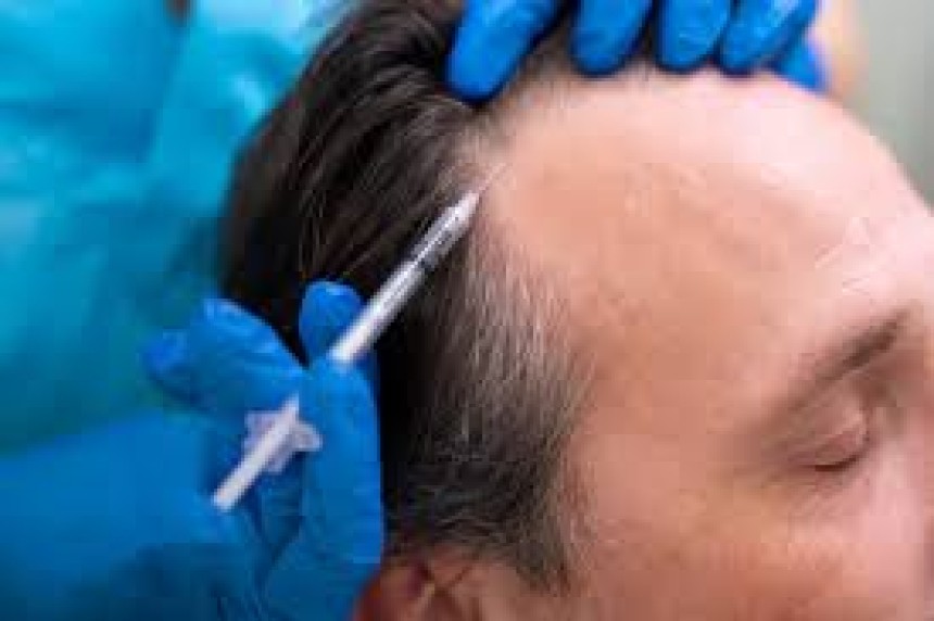 Hair Loss treatment