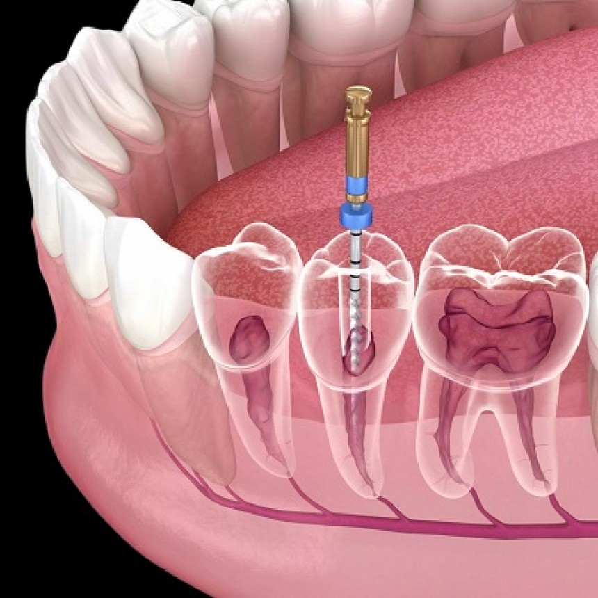https://dentalclinicislamabad.co