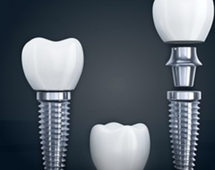 The Difference Between Oral Surgery and General Dentistry