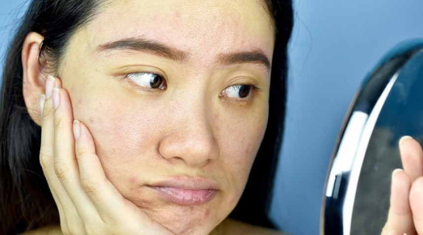dull looking skin before skincare
