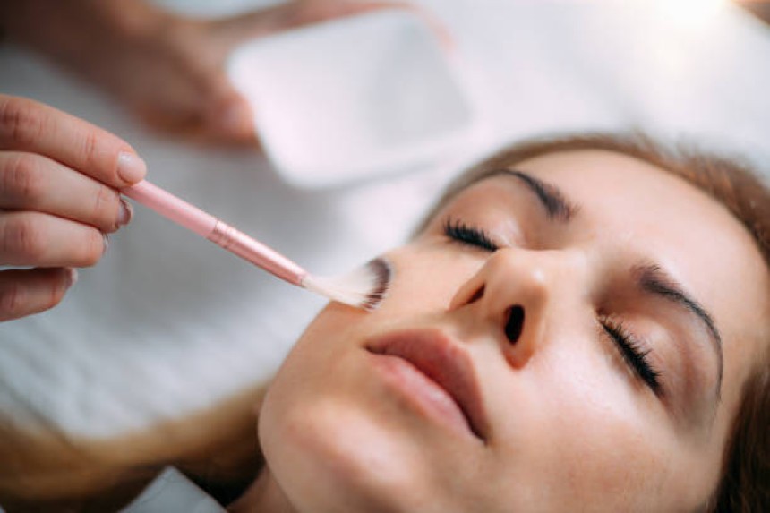 Chemical Peels in Riyadh