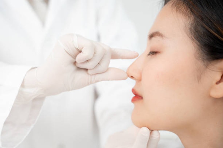 Rhinoplasty in Dubai