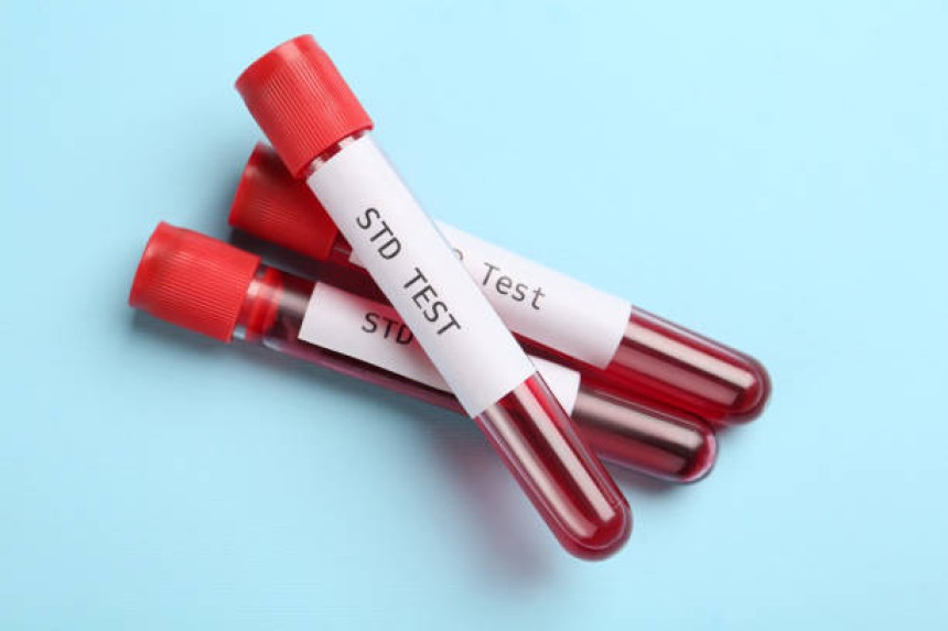 STD test in Dubai