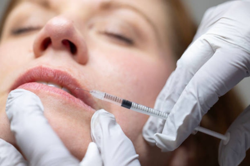 Fillers in Dubai