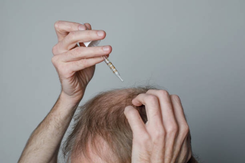 Exosomes Hair Therapy in Dubai