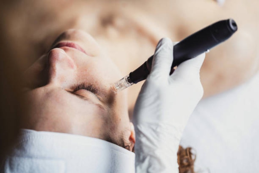 Mesotherapy in Dubai