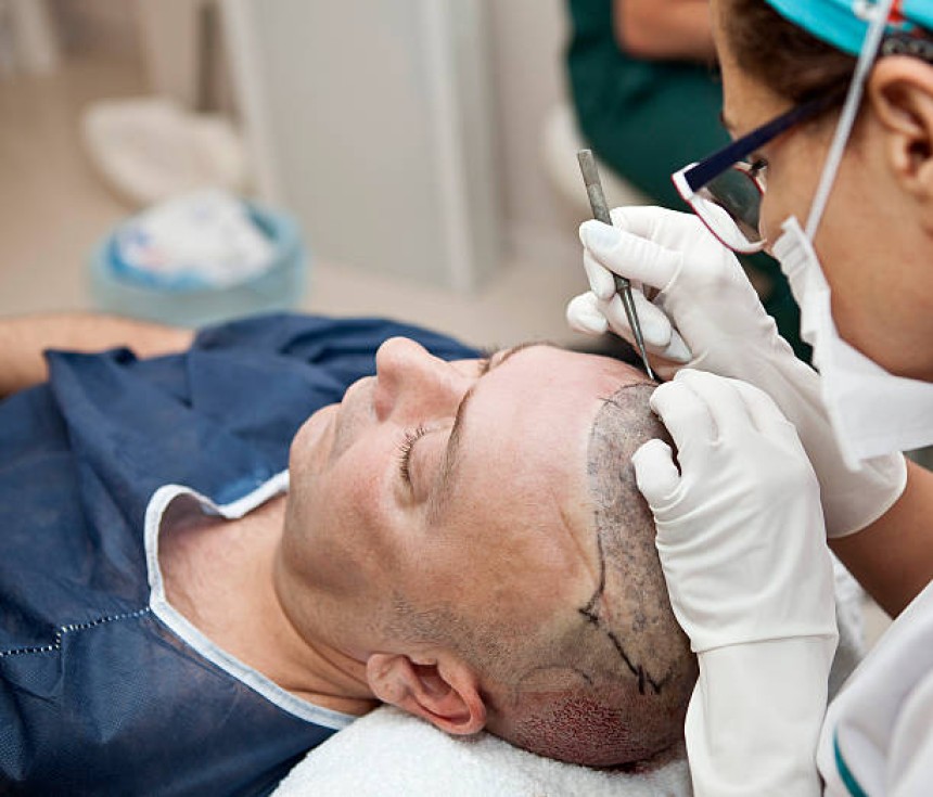 تكلفة زراعة الشعر في دبي