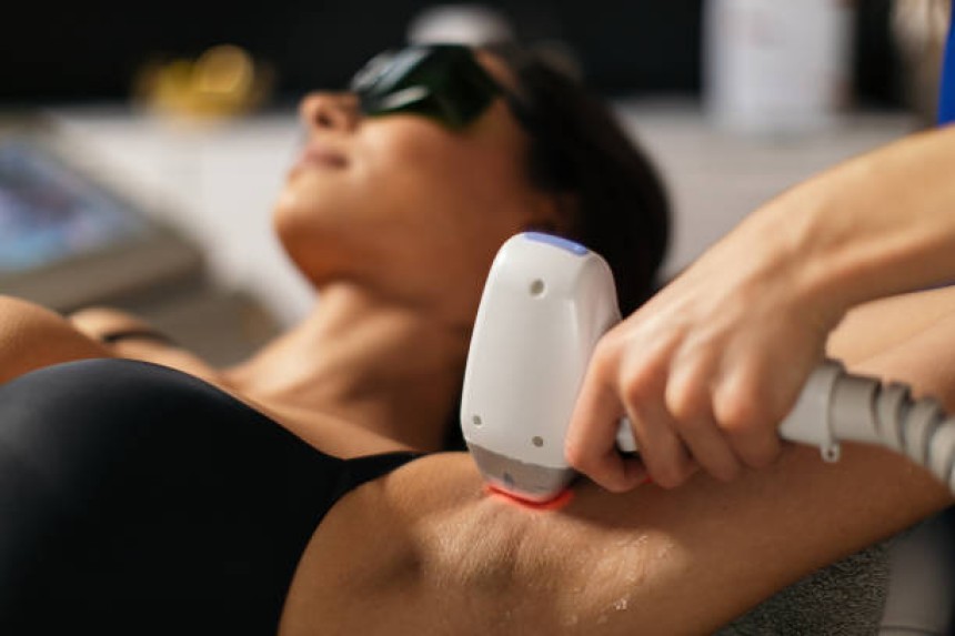 Laser Hair Removal in Dubai