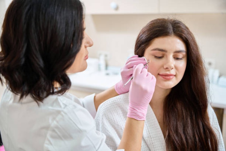 Pimple treatment in Dubai