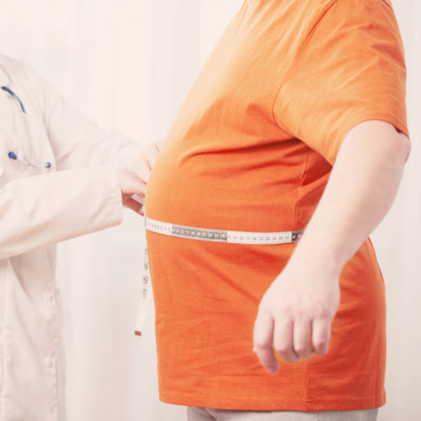 Post-Weight Loss Surgery in Dubai
