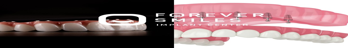 Forever Smiles Implant Center