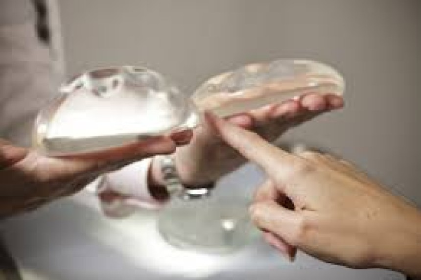 Breast Implants