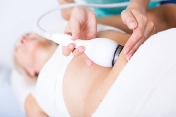 How Can coolsculpting Improve Overall Body Appearance