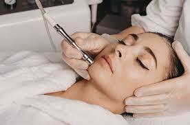 microneedling