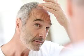 Hairpieces for men— Enhancing Your Look and offering a natural appearance