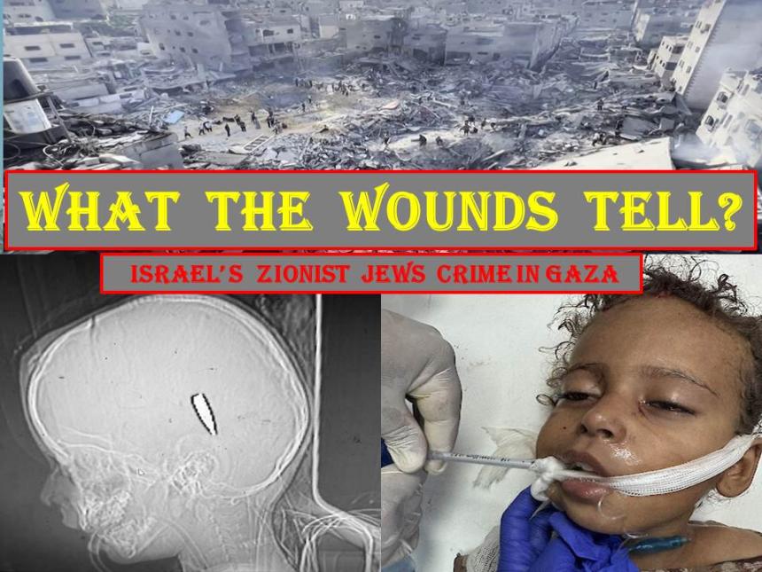 What the wounds tell? Israel’s Zionist Jews Crime in Gaza