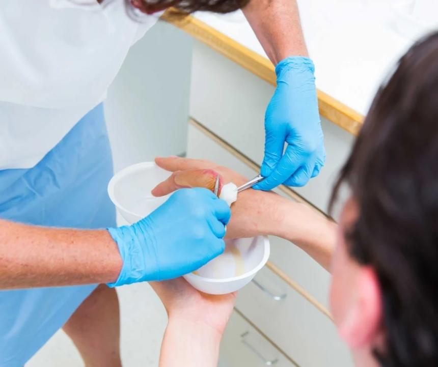 Burn Treatment: Fast and Effective Care for Skin Injuries