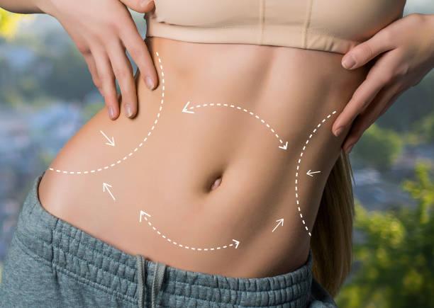 Is a Tummy Tuck Safe for Healthy Adults Seeking Contouring