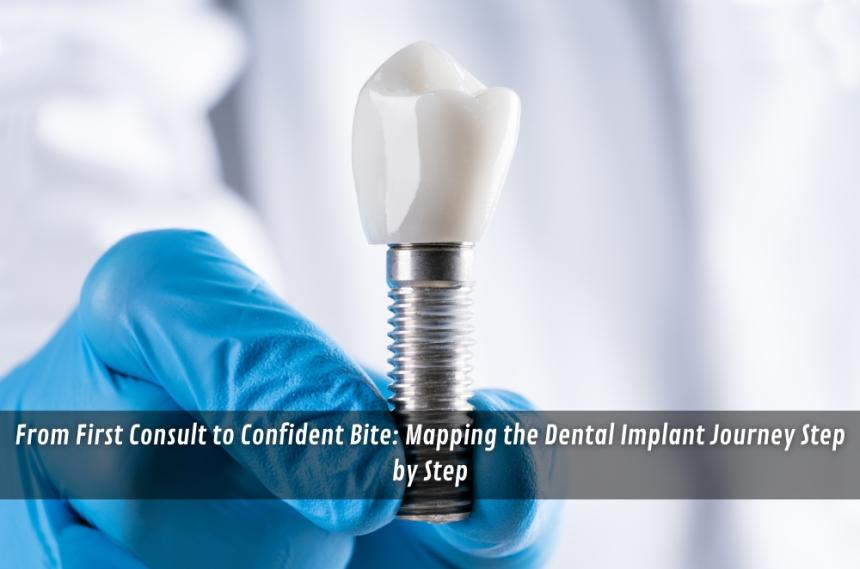 From First Consult to Confident Bite: Mapping the Dental Implant Journey Step by Step