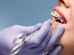 Why Your Oral Health Routine Matters More Than You Think?