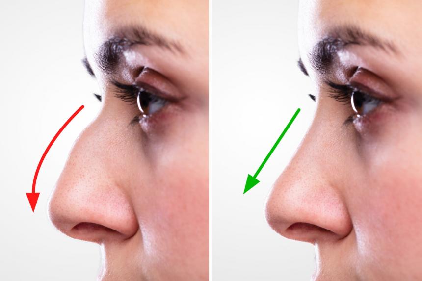 The Growing Popularity of Rhinoplasty in Islamabad for Facial Balance