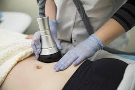 Liposuction for Elegant Figure Design