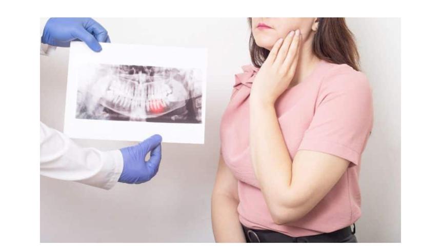 What Are Early Signs of TMJ Disorders You Shouldn't Ignore?