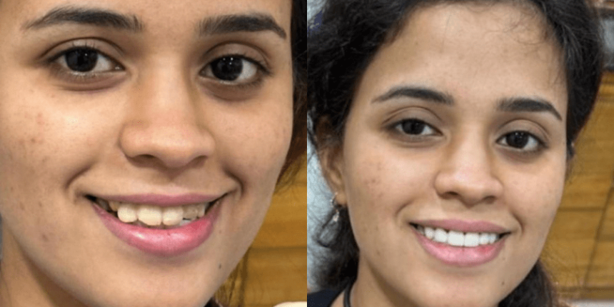 Best dentist in Andheri West Mumbai