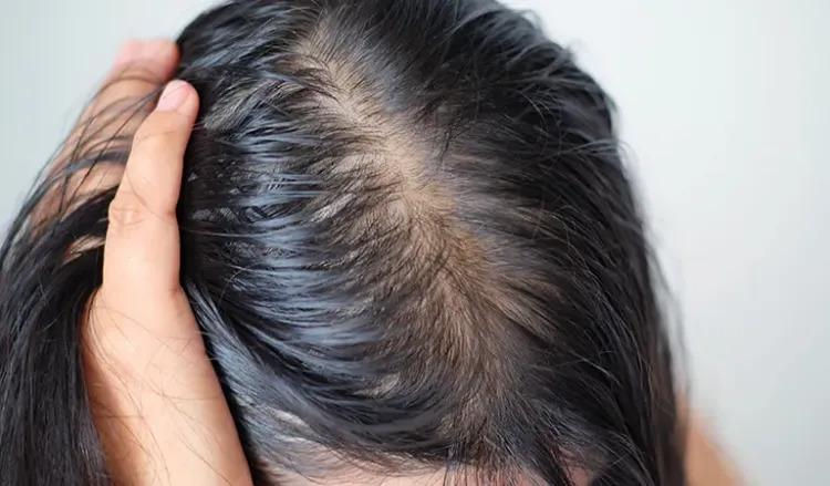 Regrow Thinning Hair