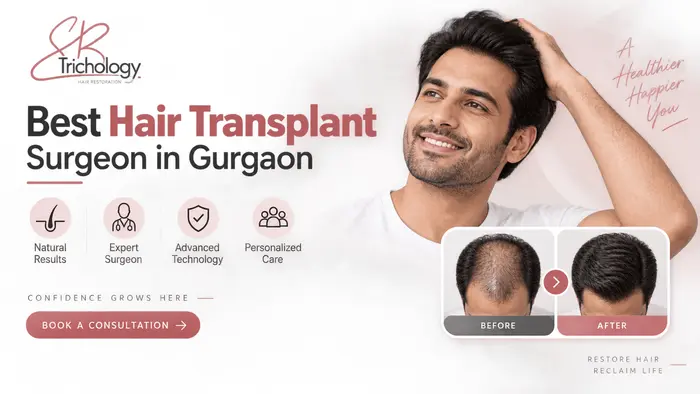 hair transplant surgeon in Gurgaon