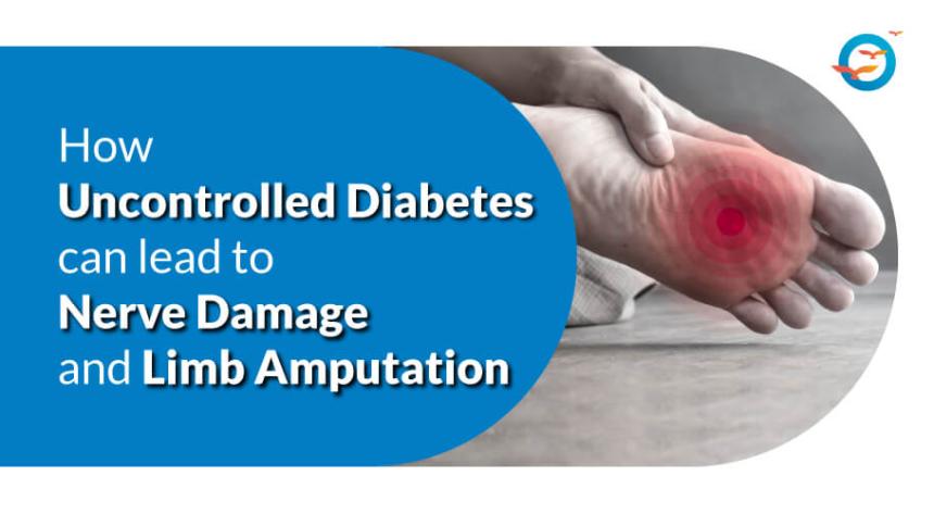 diabetes nerve damage