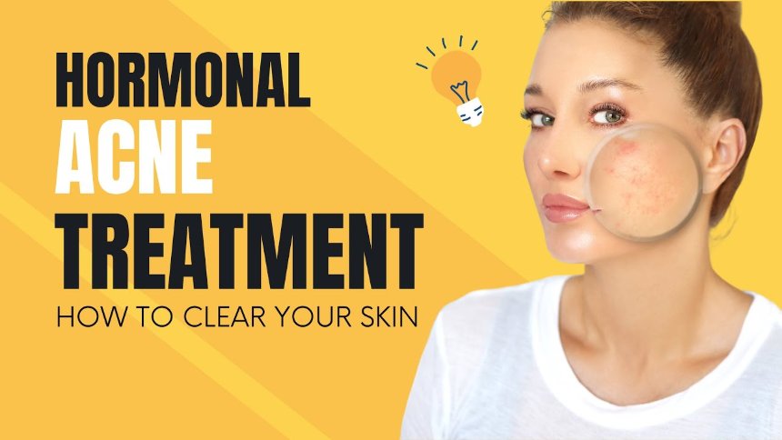The Best Treatments for Hormonal Skin Ageing in Women